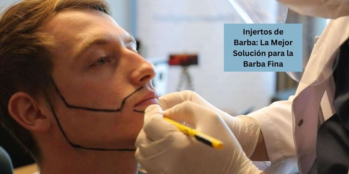 Injertos de Barba: La Mejor Solución para la Barba Fina